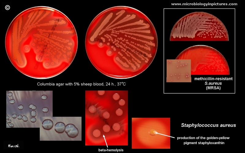Staphylococcus aureus picture